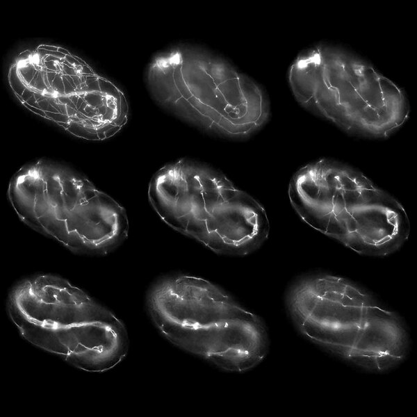 IHC of c. elegans labled with DSHB antibody DLG1 aginst DLG-1 (Discs Large). Image credit: Nonet Laboratory, Washington University Medical School.